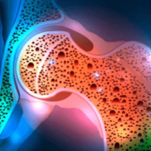 TRATAMENTO E PREVENÇÃO DA OSTEOPOROSE